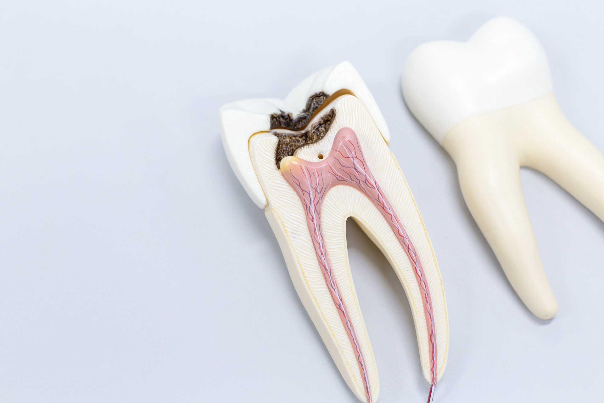 Zahnarztpraxis Roßmann Endodontie Wurzelkanalbehandlung